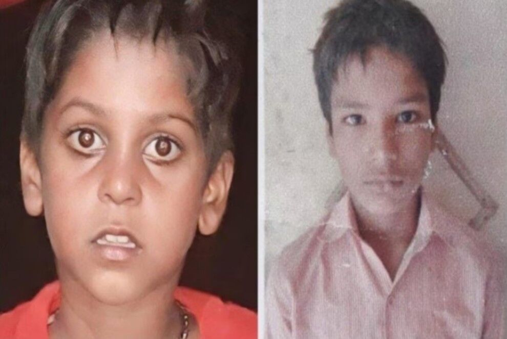 Agra News: फतेहपुर सीकरी के गांव देवरी में रहस्यमयी बीमारी से दो बच्चों की मौत, अभी भी कई बीमार