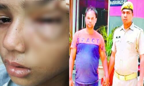 Uttar Pradesh News : हैंड राइटिंग खराब होने पर छात्रा को शिक्षक ने बेरहमी से पीटा, एक आंख से दिखना हुआ बंद, आरोपी गिरफ्तार