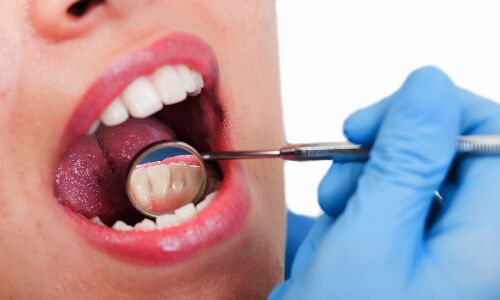 Oral Cancer : कोरोना काल में लोगों में बढ़ा ओरल कैंसर का खतरा, तेजी से चपेट में आ रहे हैं युवा