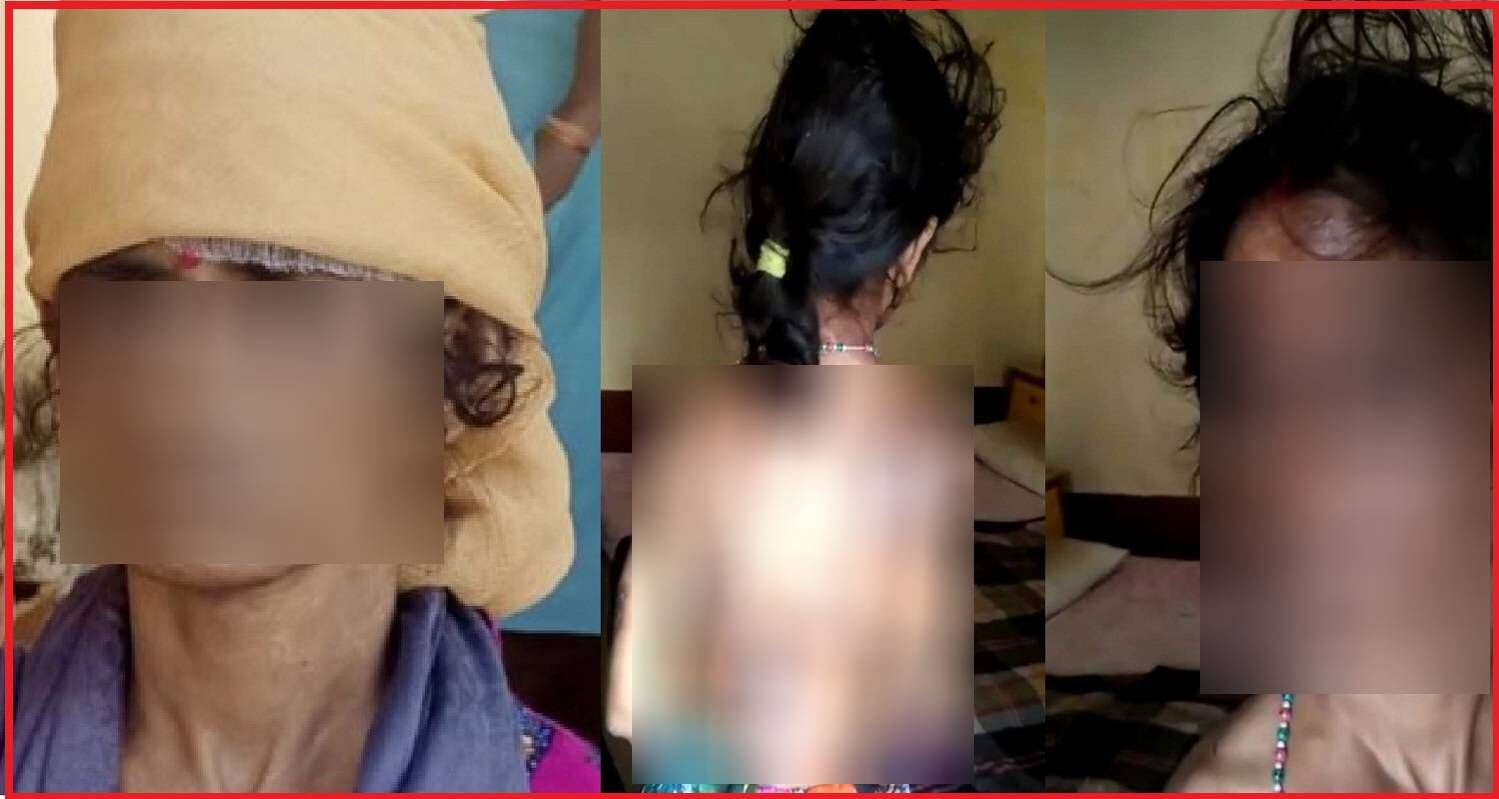 मुंह में कपड़ा ठूंस गर्म तवे से प्रीति को जलाती थी क्रूर सास, ननद और ससुर भी पीछे नहीं थे हैवानियत में : मानसिक रूप से कमजोर पति की बीवी की रोंगटे खड़े करने वाली दास्तां