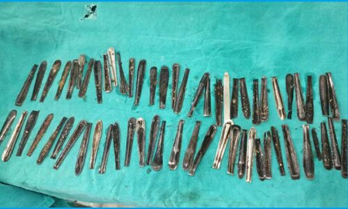 नशामुक्ति केंद्र में मरीज को चम्मच खाने पर किसने किया मजबूर, पेट से निकाली गयीं 5 दर्जन से अधिक चम्मचें