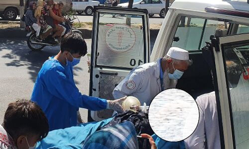 Kabul Blast: अफगानिस्तान में आत्मघाती हमला, 46 महिलाओं और लड़कियों समेत 53 की मौत