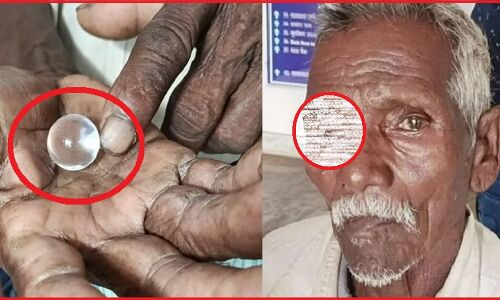 सावधान ! असली आंख निकालकर उसकी जगह खेलने वाले कंचे भी लगा सकता है कोई एनजीओ, झारखंड में सामने आ चुका है ऐसा अनोखा मामला