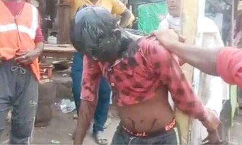 Bahraich News: चोरी के आरोप में दलित युवक को दी तालिबानी सजा, मुँह पर कालिख पोतकर काट दी आधी मूँछ