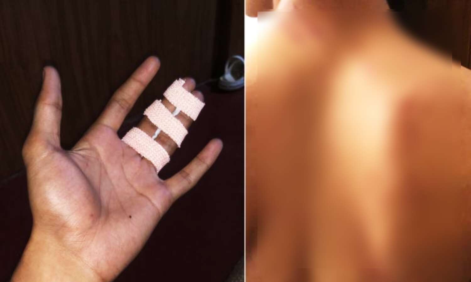 Kerala News : कॉलेज के सीनियर्स ने की छात्र से रैगिंग, विरोध करने पर बेरहमी से मारपीट, कान के पर्दे में आई गंभीर चोट
