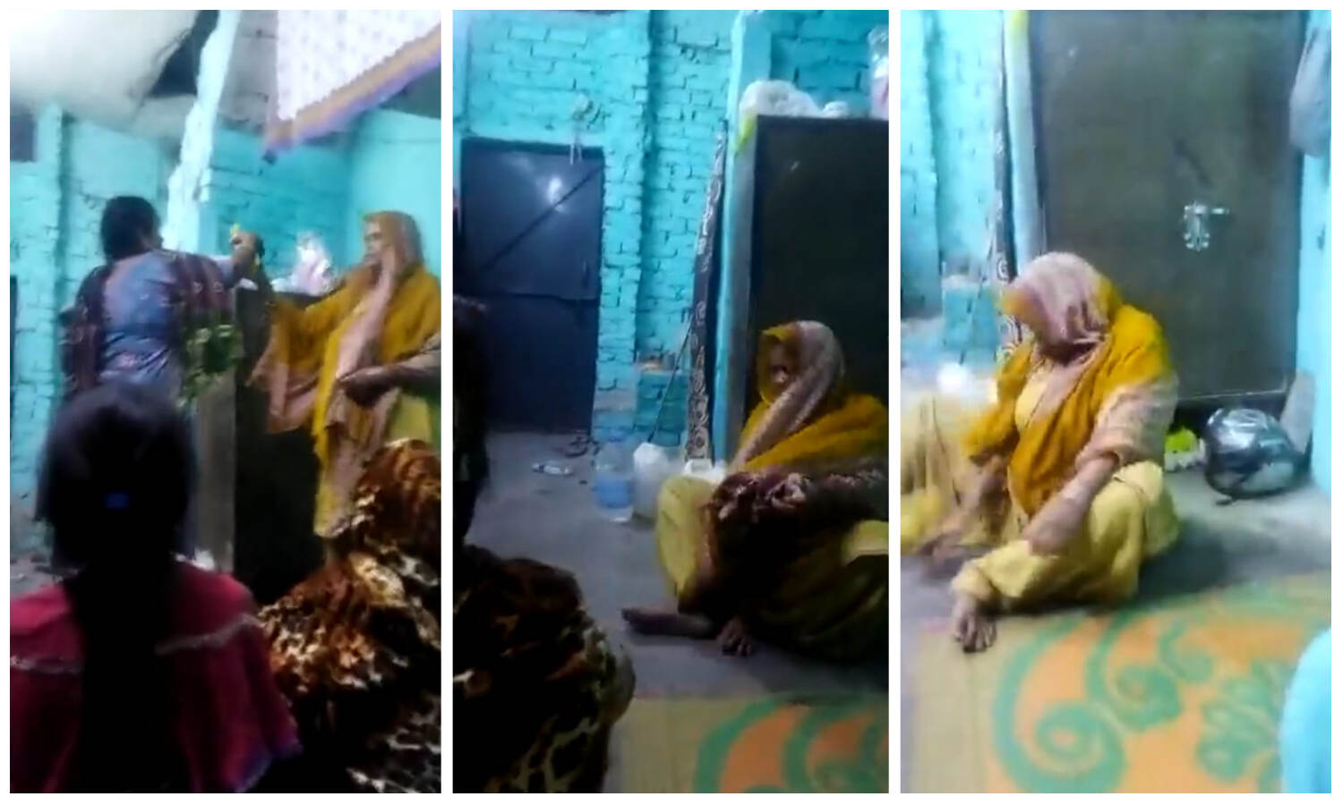 हल्दी की रस्म में बच्चन का शराबी डांस बना जानलेवा, नाचने में बोतल से छिटकी तेजाब में झुलसा दो सगी बहनों का चेहरा