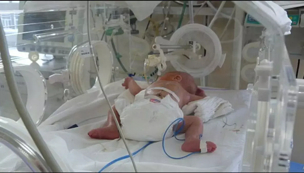 Chhattisgarh News: छत्तीसगढ़ के अस्पताल में बड़ी लापरवाही, चार घंटे गुल रही बिजली, SNCU में चार नवजात की मौत