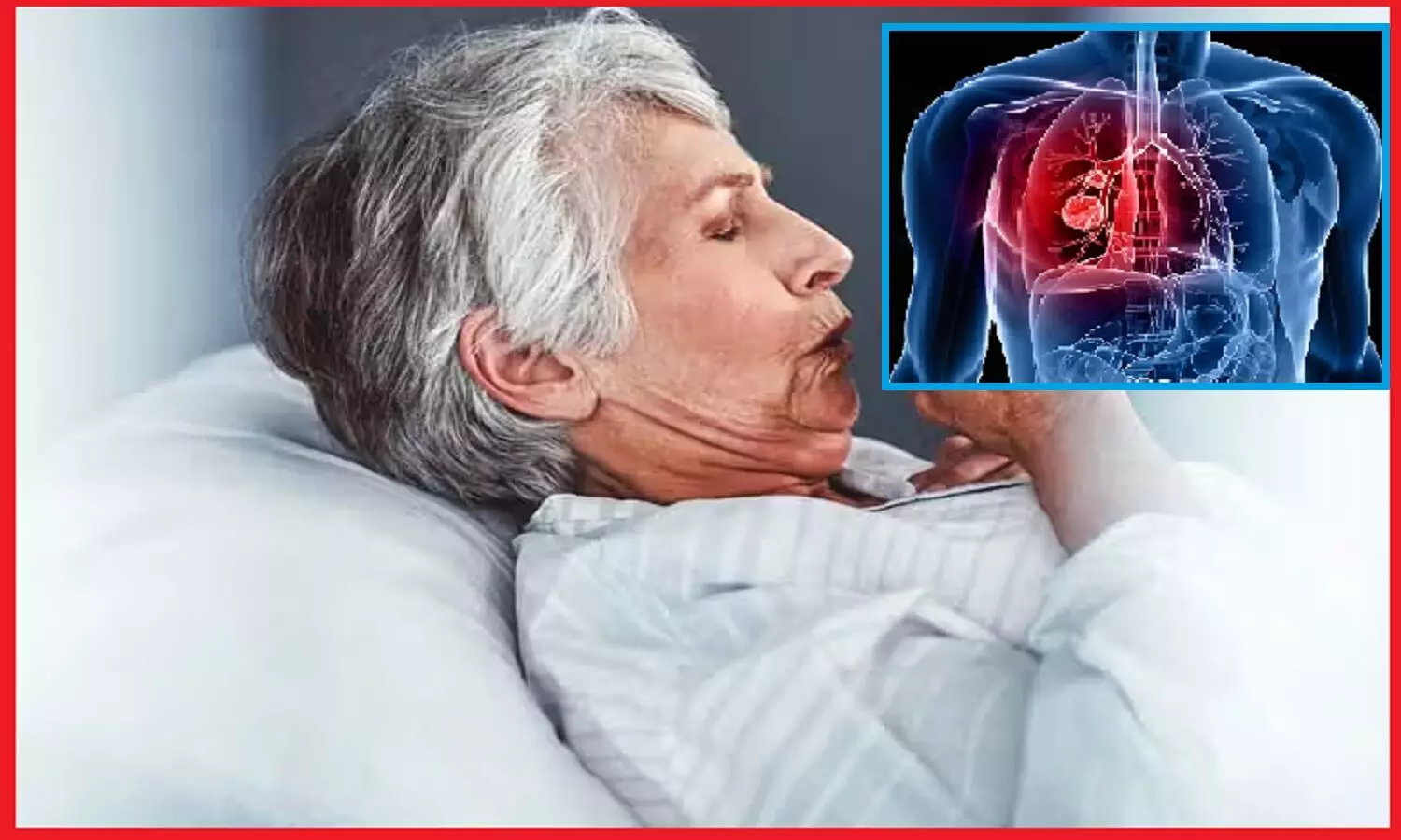 जानिये क्या है COPD जो बन चुका है संयुक्त राज्य अमेरिका में मृत्यु का तीसरा प्रमुख कारण और भारत में भी बढ़ रहे हैं तेजी से इसके मरीज !