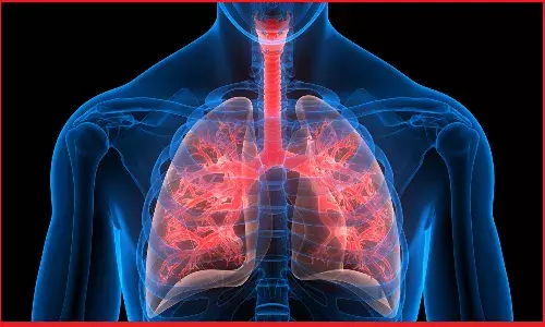 फेफड़े का संक्रमण और खांसी जो जल्दी ठीक नहीं हो रही तो इन लक्षणों को बिल्कुल न करें नजरंदाज, एक्सपर्ट डॉक्टर से जानिए उपाय !