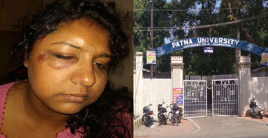 छात्राओं से छेड़छाड़ का विरोध करने पर पटना विश्वविद्यालय की प्रोफेसर पर लंपटों ने किया जानलेवा हमला