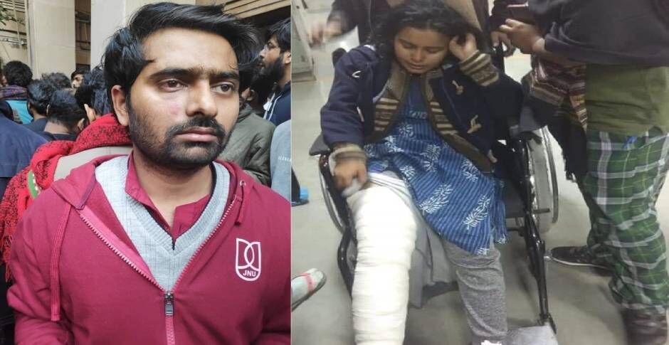 JNU में ABVP पर मारपीट का फिर लगा आरोप, छात्रा का तोड़ा पैर