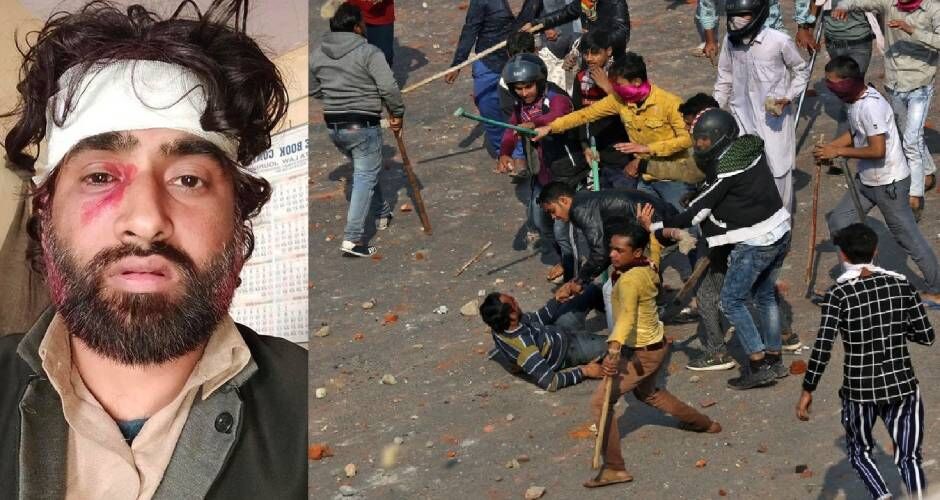 दिल्ली दंगा कवर कर रहे पत्रकार पर जानलेवा हमला, दंगाइयों ने तमंचे की नोक पर पैंट उतरवा जांचा लिंग