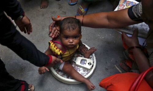 देश में हर रोज कुपोषण से मर रहे एक हजार से पंद्रह सौ बच्चे, आंगनबाड़ी केंद्रों के बंद होने का असर