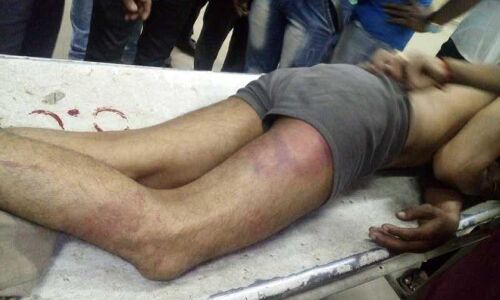 दलित युवक को पुलिसकर्मियों ने बेहोश होने तक पीटा, जिग्नेश मेवानी ने किया ​वीडियो शेयर