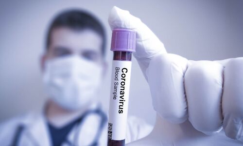 टेस्ट किट्स के अभाव में भारत में नहीं पता लग पा रहे कोरोनावायरस पीड़ितों के कुल मामले