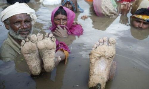 आज प्रधानमंत्री के जन्मदिन से होगी नर्मदा नदी के मरणदिन की शुरुआत : मेधा पाटकर