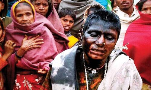 हिमाचल में 82 साल की बुजुर्ग को डायन बता जान से मारने की कोशिश, ताकि करोड़ों की जायदाद पर कर सकें कब्जा