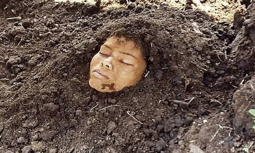 अंधविश्वास : वज्रपात में झुलसी युवती तो इलाज के बजाय घंटों तक रखा गोबर में दबाकर