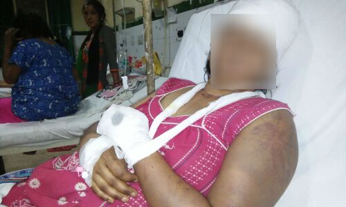 संपत्ति के लिए सूदखोर परिवार ने अपने ही घर की महिला के बाल काट नमक-मिर्च के साथ ठूंस दिए गुप्तांग में