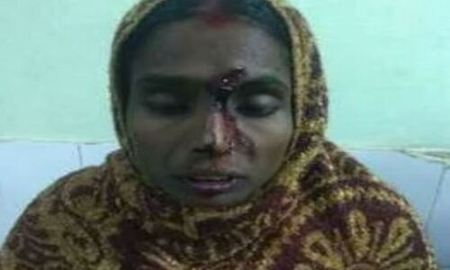 बकाया मजदूरी मांगने पर रोजगार सेवक ने फोड़ा महिला का सिर, एक अन्य की हालत गंभीर