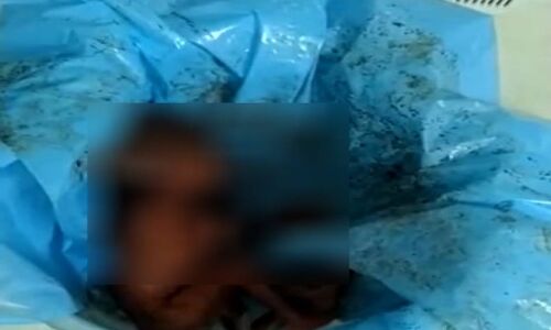 22 घंटे तक अस्पताल के बास्केटनुमा कूड़ेदान में खून से लथपथ हालत में तड़पती रही प्री-मैच्योर बच्ची,  वीडियो हुआ वायरल