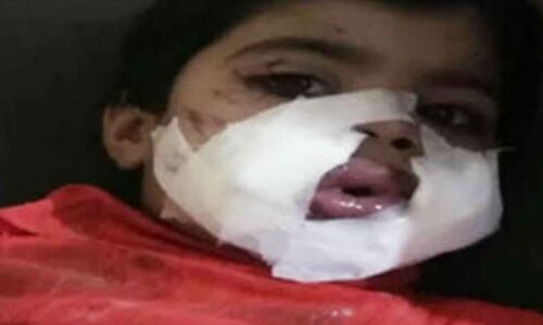 3 साल की बच्ची के मुंह में पड़ोसी युवक ने फोड़ा बम, हालत नाजुक
