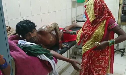 रायबरेली में पिपरमेंट निकालने की टंकी में हुआ ब्लास्ट, आधा दर्जन लोग बुरी तरह झुलसे