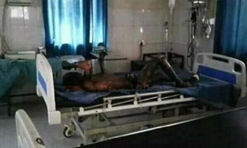 बिहार में सरकारी जमीन पर बसे दलित परिवार को झोपड़ी में बांधकर जिंदा जलाया