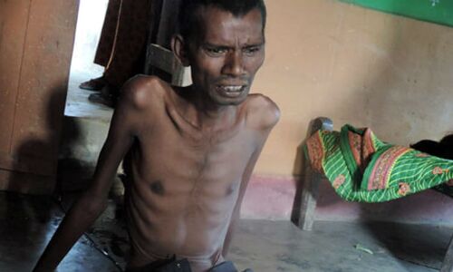 यूरेनियम खदान के विस्थापितों को पीने का पानी नहीं