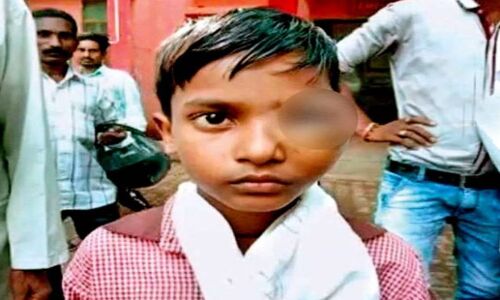 बिजनौर में दूसरी क्लास की बच्ची ने पूरा नहीं किया होमवर्क तो शिक्षक ने कर दिया लहुलूहान