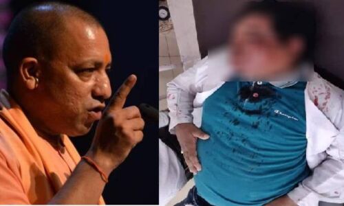 यूपी में पुलिस और स्वास्थ्यकर्मियों पर हुए हमले के बाद योगी हुए सख्त, कहा NSA के तहत होगी कार्रवाई