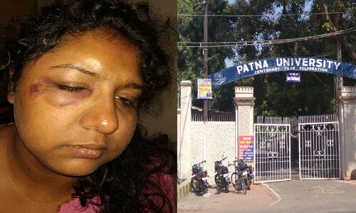 छात्राओं से छेड़छाड़ का विरोध करने पर पटना विश्वविद्यालय की प्रोफेसर पर लंपटों ने किया जानलेवा हमला