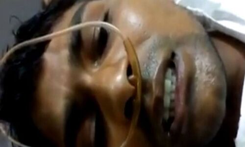 जातिगत उत्पीड़न से तंग गोरखपुर विश्वविद्यालय के दलित शोध छात्र ने की आत्महत्या की कोशिश