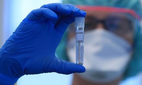 रहस्य : नोएडा में 38 कोरोना मृतकों का हुआ पोस्टमार्टम, लेकिन रिपोर्ट में मिला सिर्फ एक पॉजिटिव