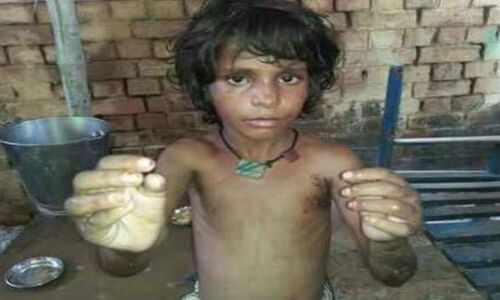 इतनी दरिंदगी कैसे कर सकती है एक सौतेली मां