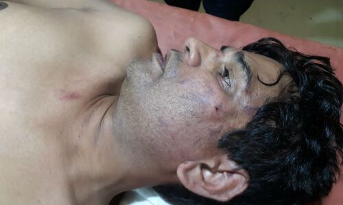 लिंचिंग के शिकार महात्मा गांधी विश्वविद्यालय के शिक्षक संजय कुमार की मानसिक हालत नाजुक, रात को पड़ते हैं दौरे