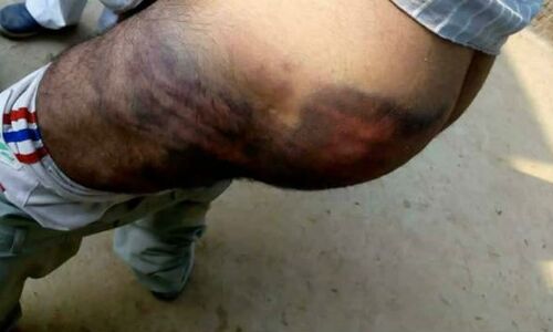 योगीराज है कि जंगलराज, घूस नहीं देने पर पुलिसवालों ने की ये हालत