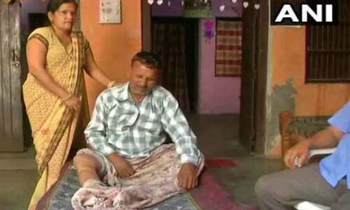 सिर पर लगी चोट के लिए हुआ था भर्ती, डॉक्टर ने कर दिया पैर का आॅपरेशन