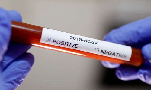 Coronavirus: भारत में पिछले 12 घंटों में 547 नए मामले आए सामने, 30 लोगों की मौत