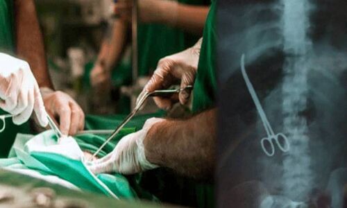 3 महीने पहले नामी अस्पताल में हुई सर्जरी में महिला के पेट में डॉक्टरों ने छोड़ दी थी चिमटी, एक्सरे से हुआ खुलासा