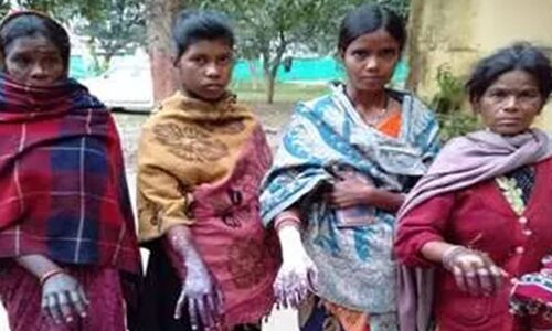 अंधविश्वास : झारखंड में पंचायत ने चार महिलाओं को डायन बताकर खौलते पानी से सिक्का निकालने की दी सजा