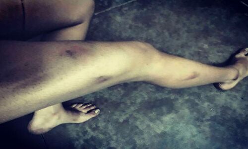 जेएनयू मार्च पर पुलिस का लाठीचार्ज, लड़कियों के खींचे बाल फाड़े कपड़े