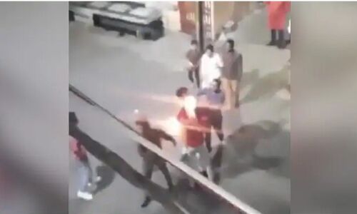 मुंह से आग निकालने की कोशिश कर रहा था भक्त हो गया हादसा, बॉलीवुड एक्टर बोले- भक्त ऑफ द ईयर