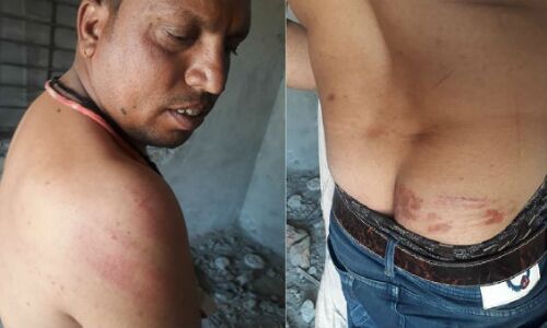 राजस्थान में दलित सरपंच को मारकर किया अधमरा