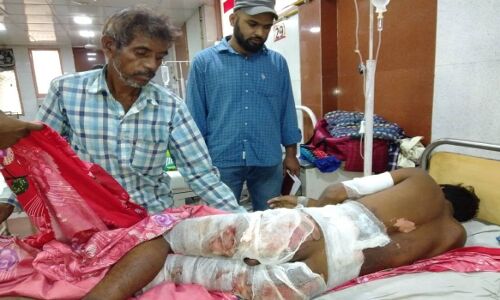 ससुराल जा रहे दलित युवा को भीड़ ने चोरी के शक में पेट्रोल डाल जला दिया था जिंदा, अब अस्पताल में जिंदगी और मौत की लड़ रहा जंग