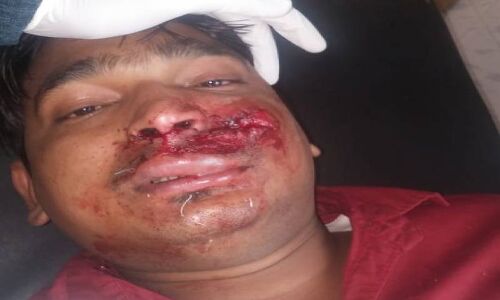 क्यों सांड सा भड़क जाता है शासन-प्रशासन मजदूरों के हाथों में लाल झंडे देख