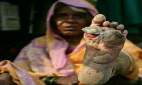 भाजपा सांसद की निगाह में किसान आंदोलनकारी हैं शहरी माओवादी