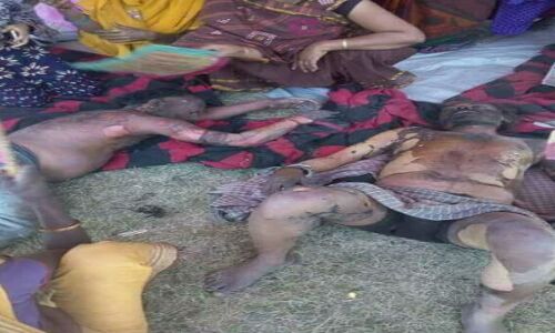 नीतीश गांधी पर देते रहे भाषण और मजदूर नेता आग के हवाले हो गए