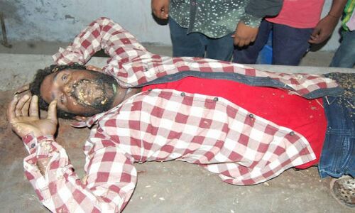 दलित युवक को प्रेम करने की मिली सजा, आंखें निकाली फिर लिंग काटा