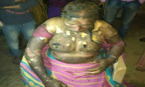 सूदखोरों ने पहले 20 हजार के बदले वसूले 2 लाख, फिर दलित महिला को जिंदा जलाया
